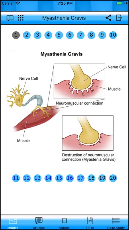 Myasthenia Gravis screenshot 1 of 8