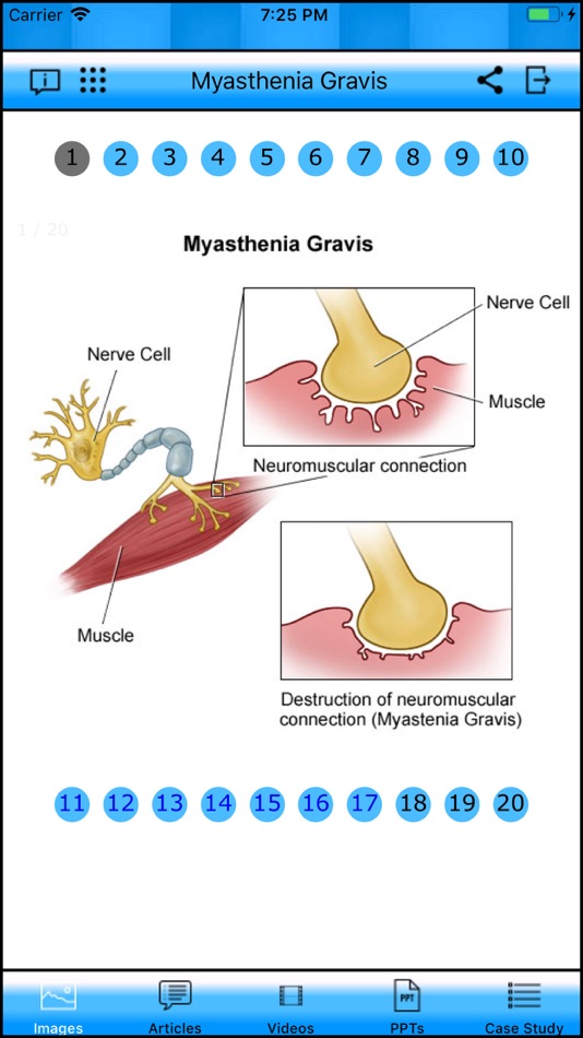 #1. Myasthenia Gravis (iOS) By: ManalSoft