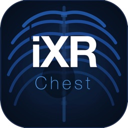 iXRchest