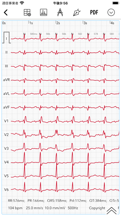 ECG Pro | 心電図マスターへの道 のスクリーンショット