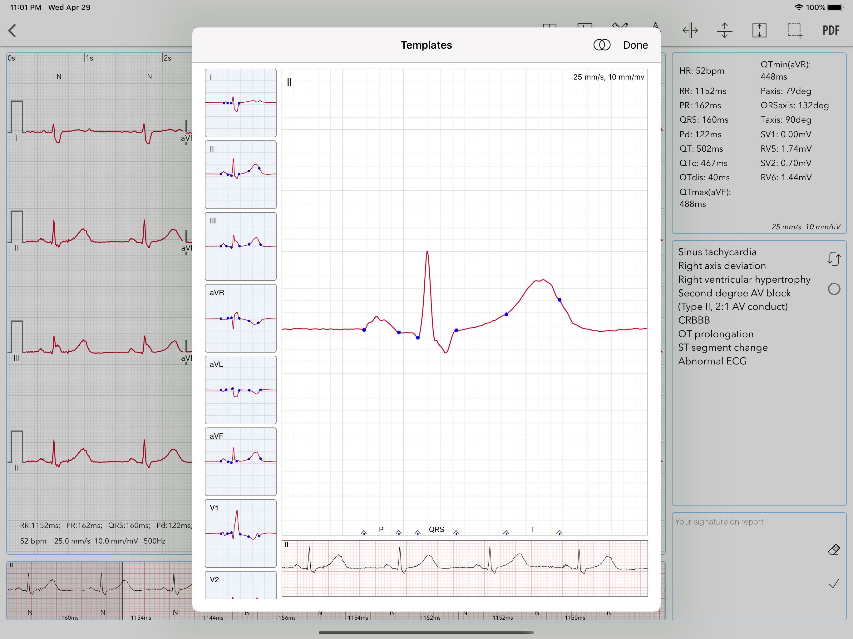 ECG Pro | Road to Mastery screenshot 17