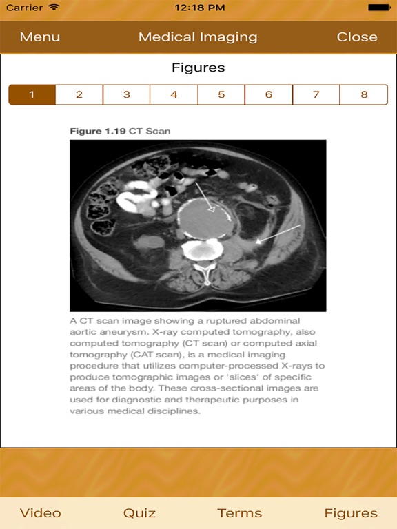 Medical Imaging iPad screenshot
