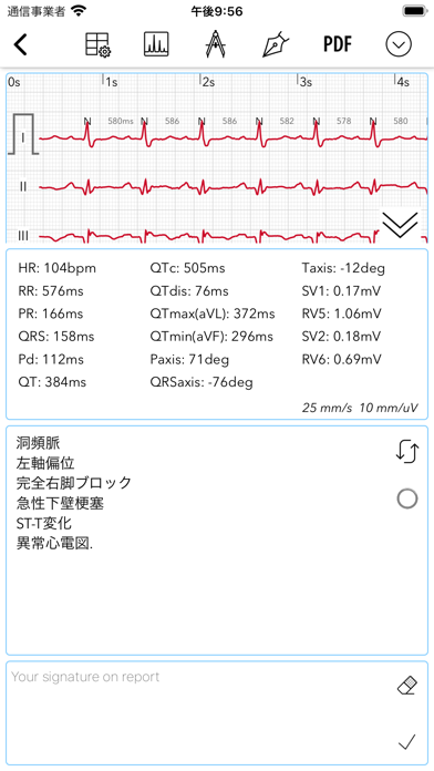 ECG Pro | 心電図マスターへの道 のスクリーンショット