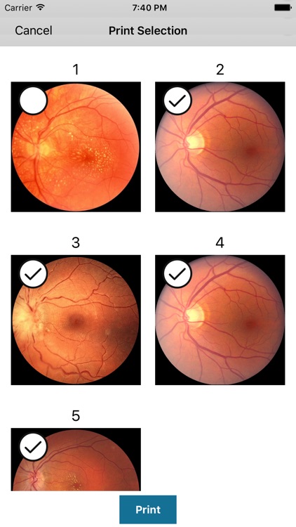 MII Ret Cam Pro-Patient Pofile screenshot-3