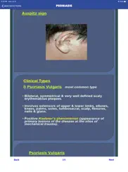 skin infections and treatments ipad resimleri 2