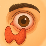 Graves and Thyroid Eye Disease