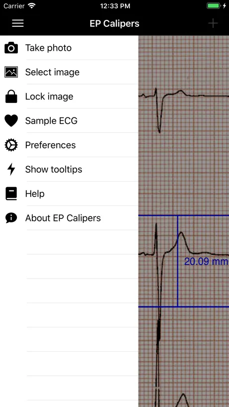 EP Calipers