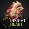 INSIGHT HEART - iPhoneアプリ