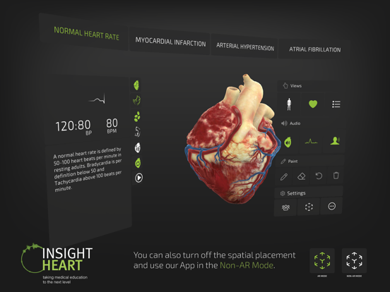INSIGHT HEART Screenshots