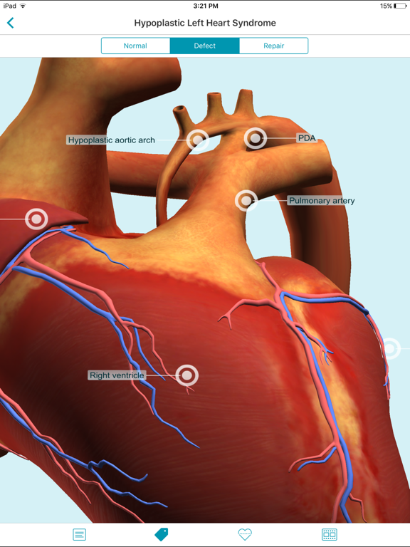 Heartpedia iPad screenshot 6 - Medical app