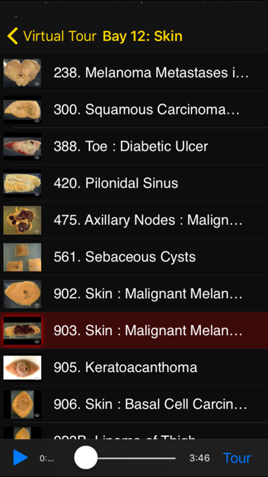 Screenshot #2 pour Images Of Disease