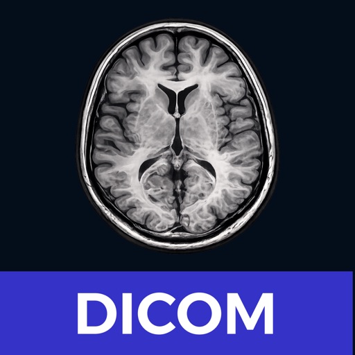 DICOM Viewer - MesDICOM