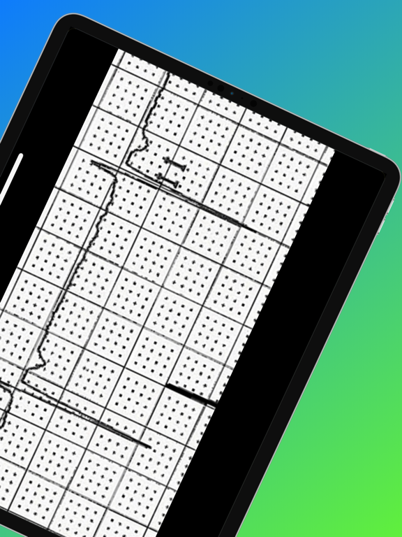 ECG Challenge iPad screenshot 6 - Medical app