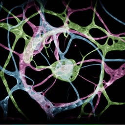 Cell Zoo - Physarium