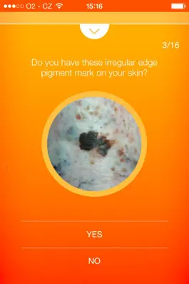 Game screenshot Melanoma Test - risk calculator of skin cancer hack