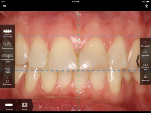 SmileHD screenshot 3