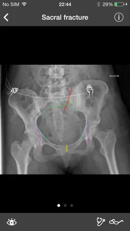 Game screenshot RealWorld Orthopaedics apk