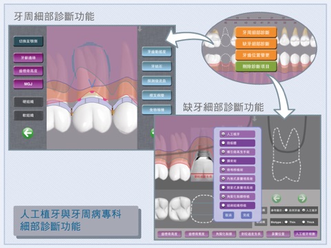 牙易「牙科診療大師(專業版)」－繁體中文版(提供試用) screenshot 3