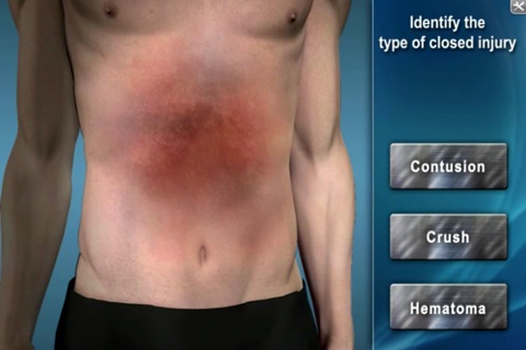 Medrills: Managing Soft-Tissue Trauma screenshot 3