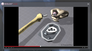 BIOLOX inside iPhone screenshot 5 - Medical app