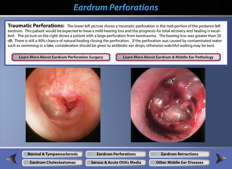 Ear Pathology