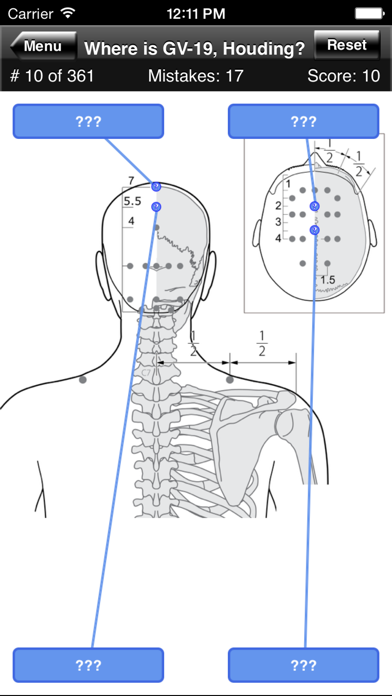 Acupuncture Points Body Quiz Screenshot