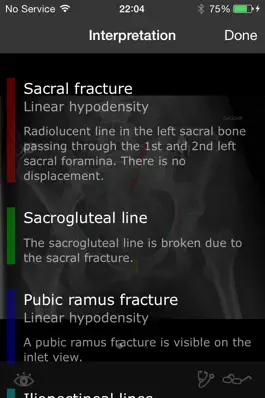 Game screenshot RealWorld Orthopaedics hack
