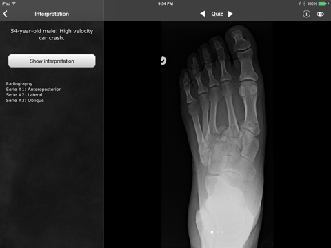 RealWorld Orthopaedics iPad screenshot 5 - Medical app