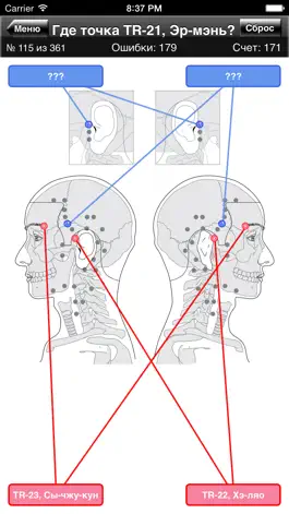 Game screenshot Викторина: Точки Акупунктуры на Теле hack