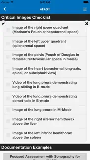sonosupport: a clinical emergency medicine and critical care ultrasound reference tool iphone screenshot 3