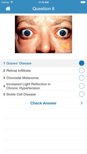Ophthalmology Training(圖2)-速報App