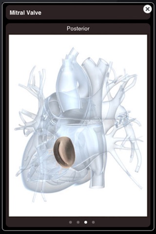 Heart Pro III - iPhone screenshot 4