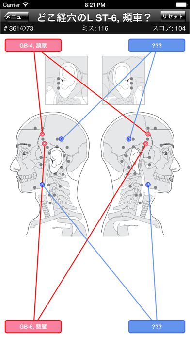 経穴ボディクイズのおすすめ画像3