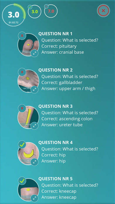 Reflexology Quiz - zones Screenshot 4