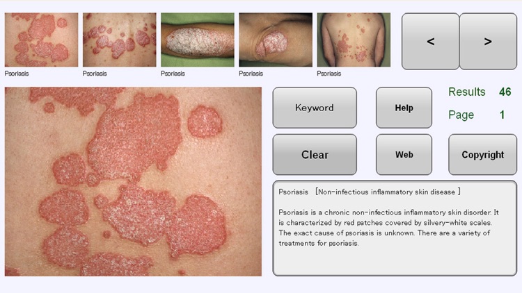 YSP Dermatology Image Database for iPhone
