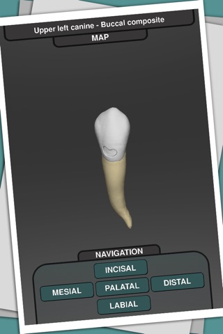 CavSim : Dental Cavity Preparations Free screenshot 3