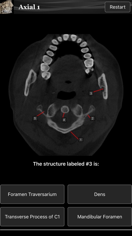 Scanatomy