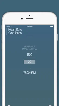 ANALYSE ECG Reporting screenshot 3