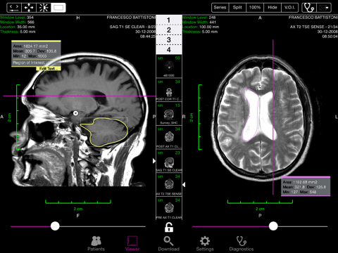 Screenshot #5 pour Keiron