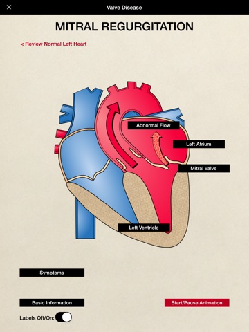 HeartCharts screenshot 3