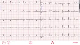 photo ekg iphone screenshot 2