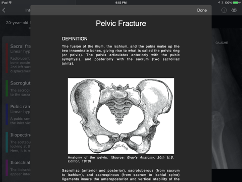 RealWorld Orthopaedics iPad screenshot 4 - Medical app