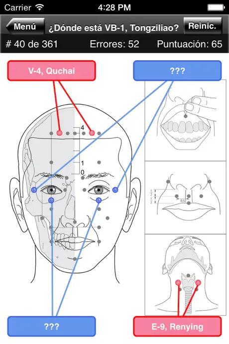 Puntos de Acupuntura del Cuerpo