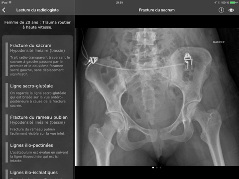 Screenshot #5 pour RealWorld Orthopaedics