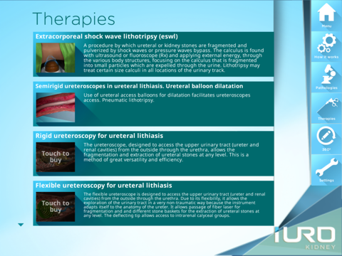 iURO Kidney Lite iPad screenshot 4 - Medical app