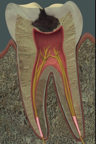 Dental Pain screenshot 3