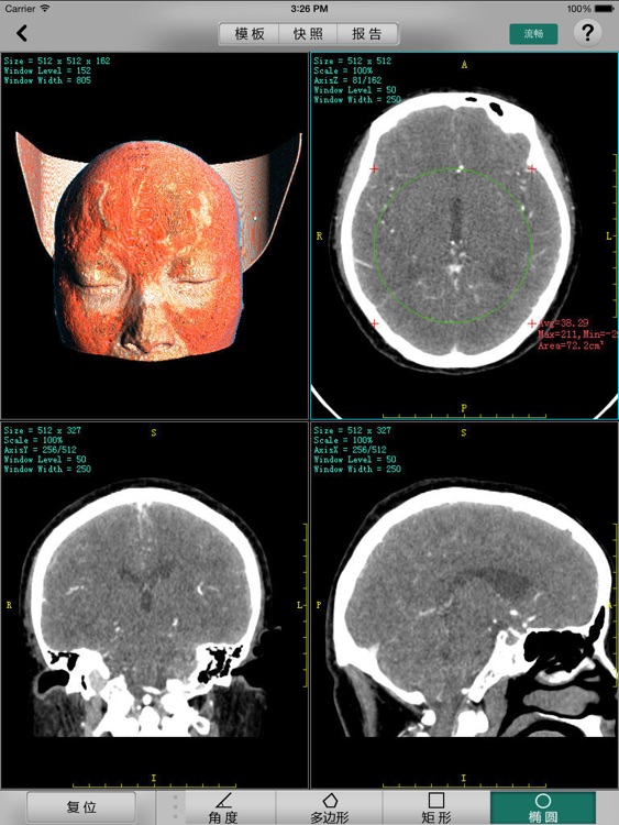 Xavier, 安博医学3D成像