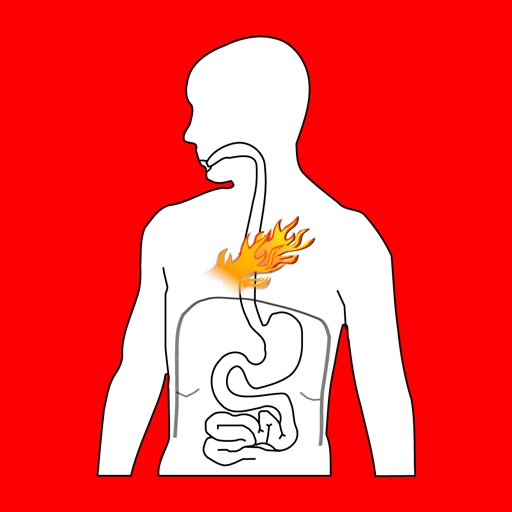 Acid Reflux Guides - Fact & Causes of Acid Reflux Symptoms, Home Remedies for Acid Reflux & Heartburn icon