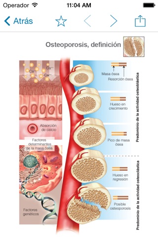 Miniatlas Osteoporosis screenshot 4