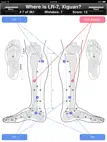 Acupuncture Points Body Quiz ipad bilder 2